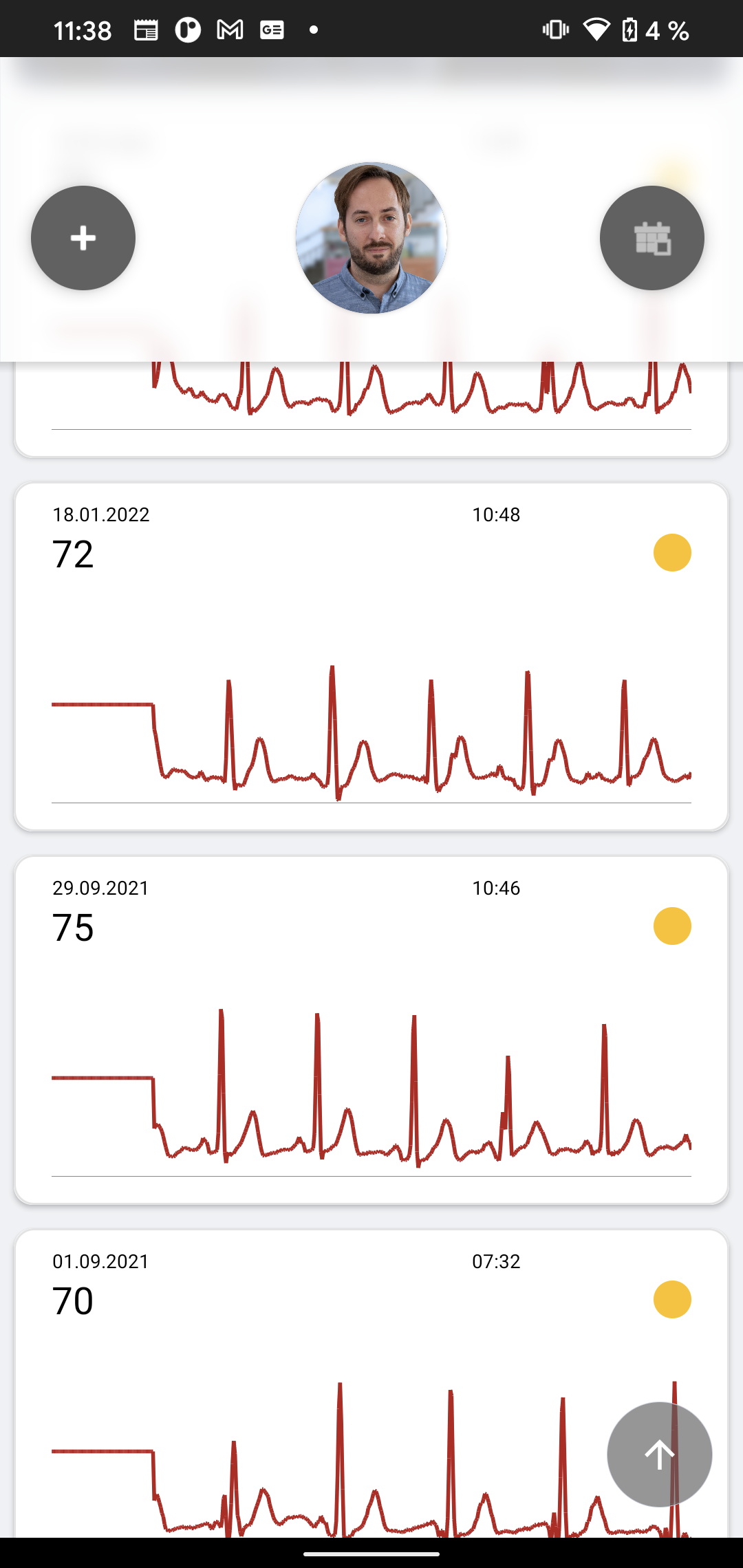 For Patients The ECG App for Detecting Heart Diseases